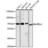 Western Blot - Anti-RELA Antibody (A0450) - Antibodies.com