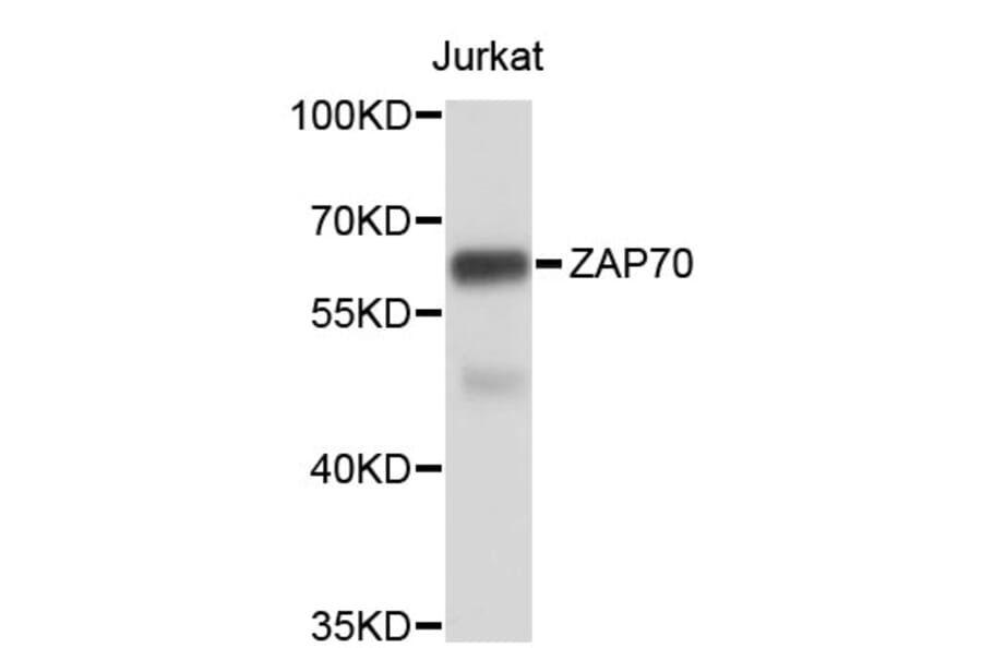 Western Blot - Anti-ZAP70 Antibody (A0454) - Antibodies.com