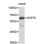 Western Blot - Anti-ZAP70 Antibody (A0454) - Antibodies.com