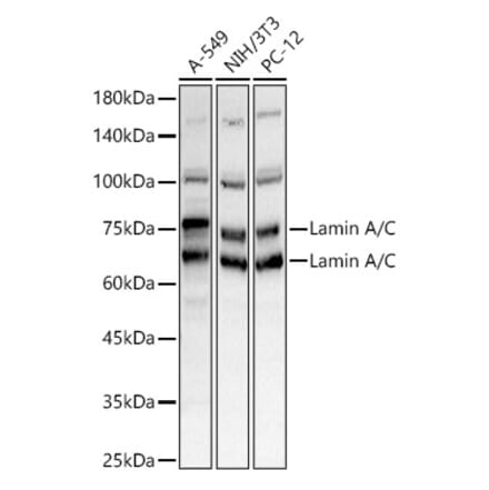 Western Blot - Anti-Lamin A Antibody (A8408) - Antibodies.com