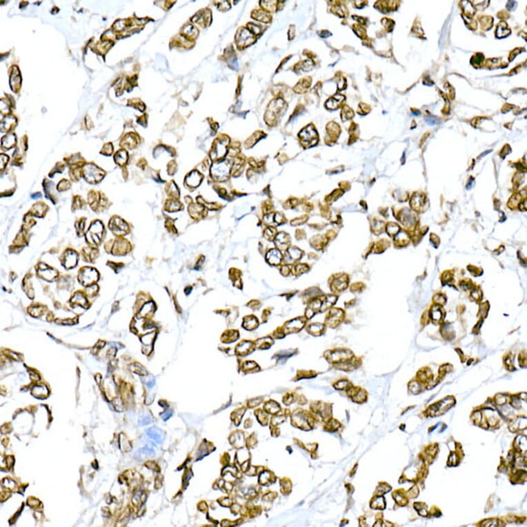 Immunohistochemistry - Anti-Lamin A Antibody (A8408) - Antibodies.com
