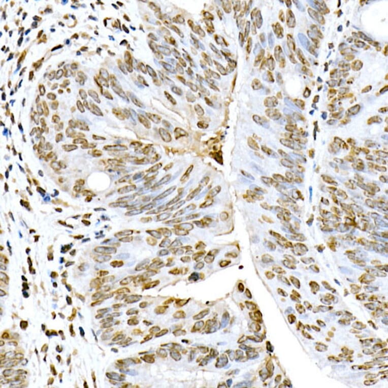 Immunohistochemistry - Anti-Lamin A Antibody (A8408) - Antibodies.com