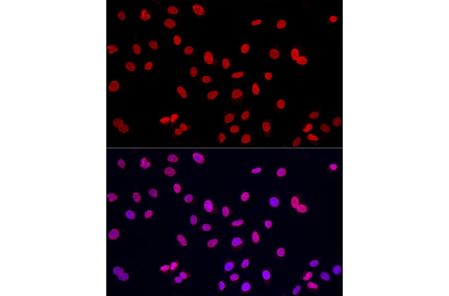 Immunofluorescence - Anti-Lamin A Antibody (A8408) - Antibodies.com