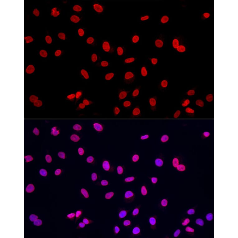 Immunofluorescence - Anti-Lamin A Antibody (A8408) - Antibodies.com
