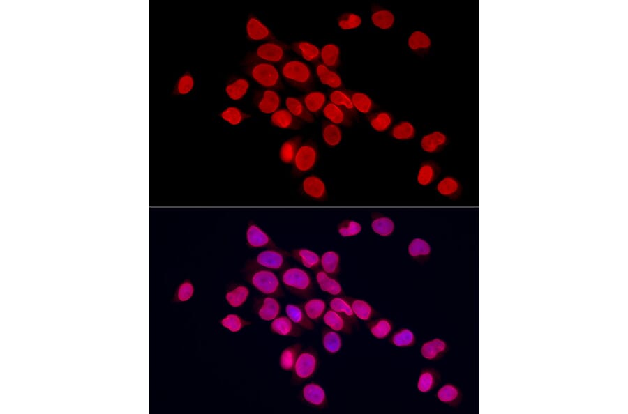 Immunofluorescence - Anti-Lamin A Antibody (A8408) - Antibodies.com