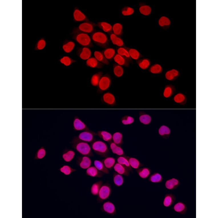 Immunofluorescence - Anti-Lamin A Antibody (A8408) - Antibodies.com