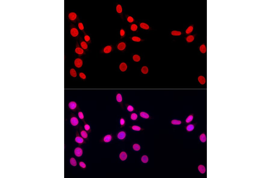 Immunofluorescence - Anti-Lamin A Antibody (A8408) - Antibodies.com