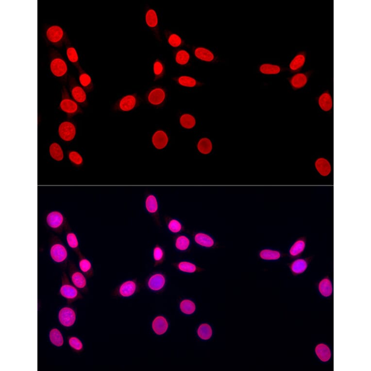 Immunofluorescence - Anti-Lamin A Antibody (A8408) - Antibodies.com