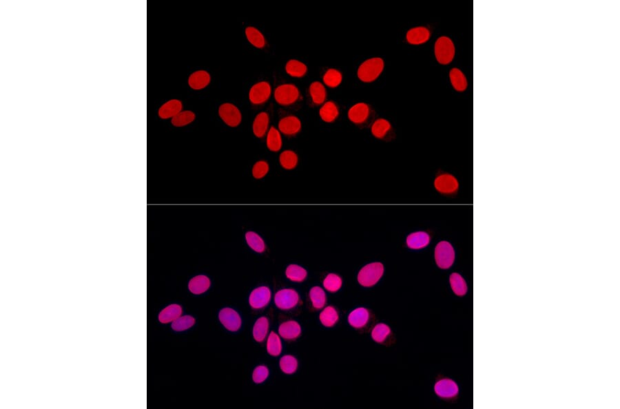 Immunofluorescence - Anti-Lamin A Antibody (A8408) - Antibodies.com