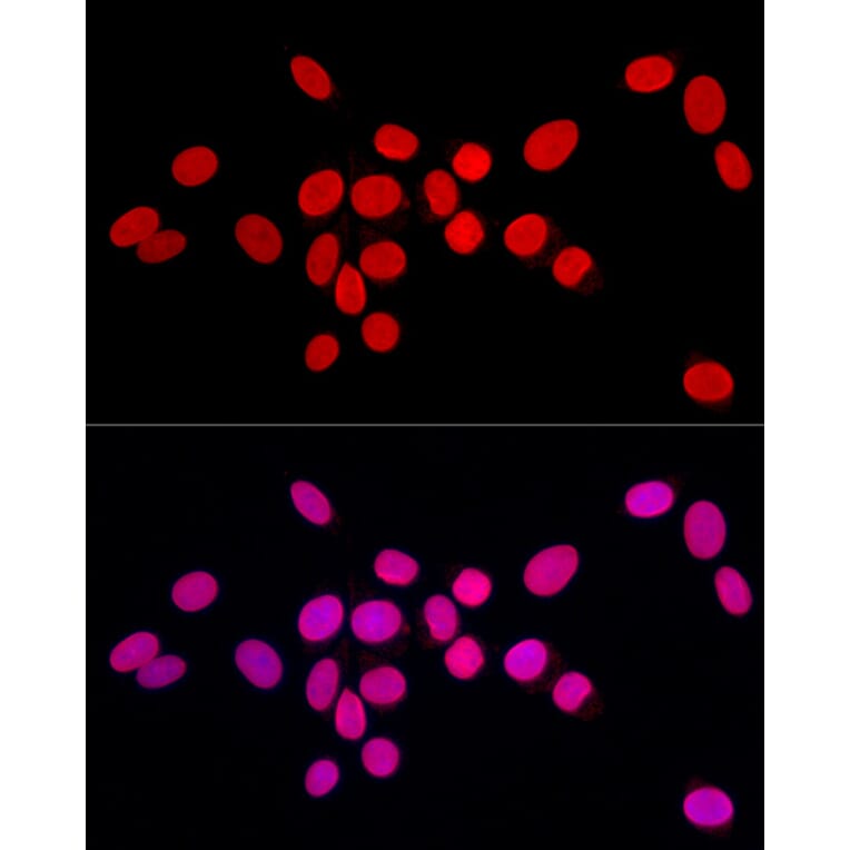 Immunofluorescence - Anti-Lamin A Antibody (A8408) - Antibodies.com