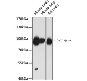 Western Blot - Anti-PKC delta Antibody (A8410) - Antibodies.com