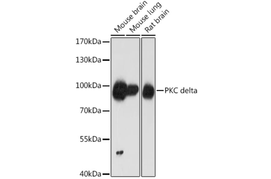 Western Blot - Anti-PKC delta Antibody (A8410) - Antibodies.com