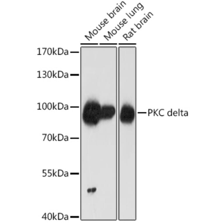 Western Blot - Anti-PKC delta Antibody (A8410) - Antibodies.com