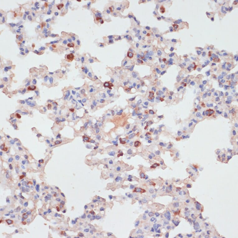 Immunohistochemistry - Anti-PKC delta Antibody (A8410) - Antibodies.com
