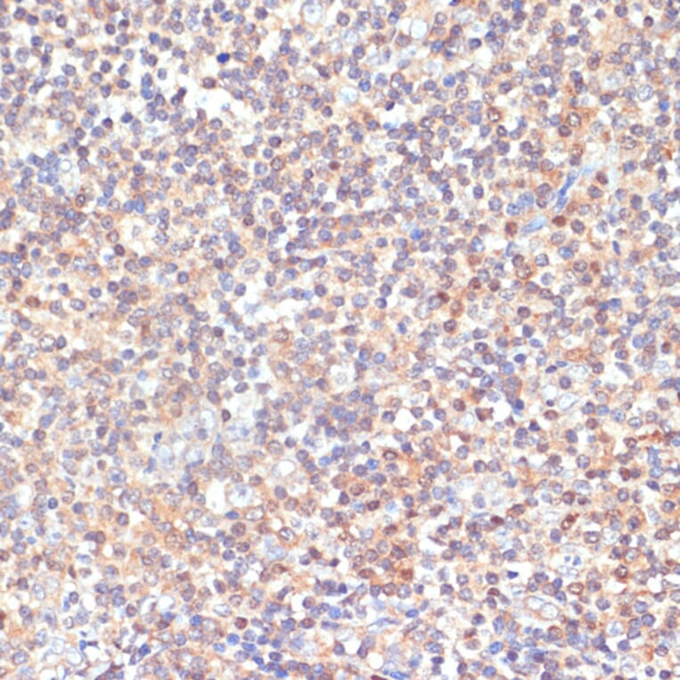 Anti-PKC delta Antibody (A8410) | Antibodies.com