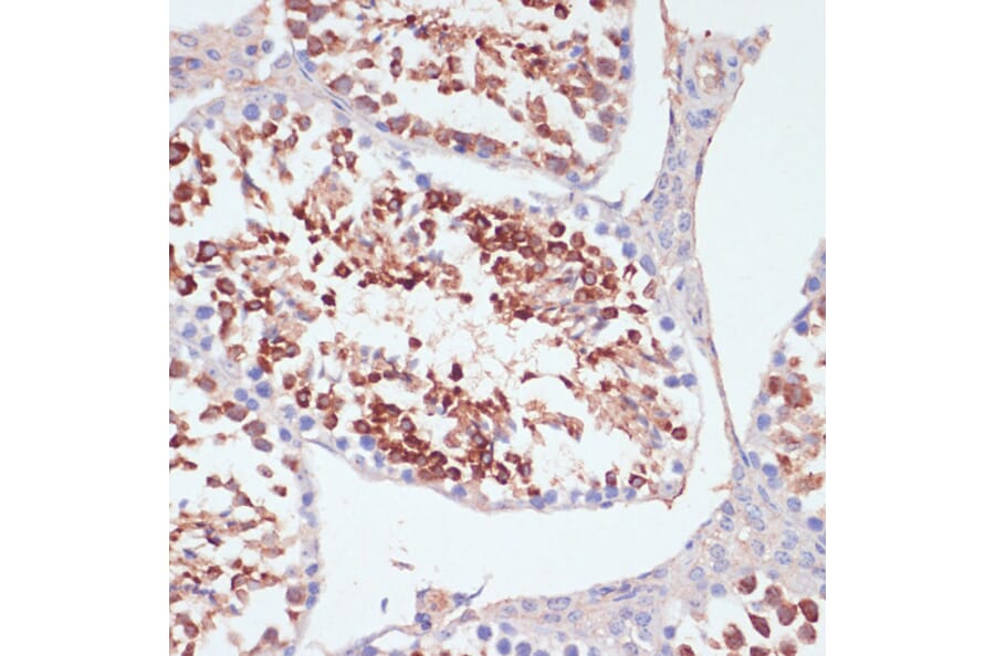 Immunohistochemistry - Anti-PKC delta Antibody (A8410) - Antibodies.com