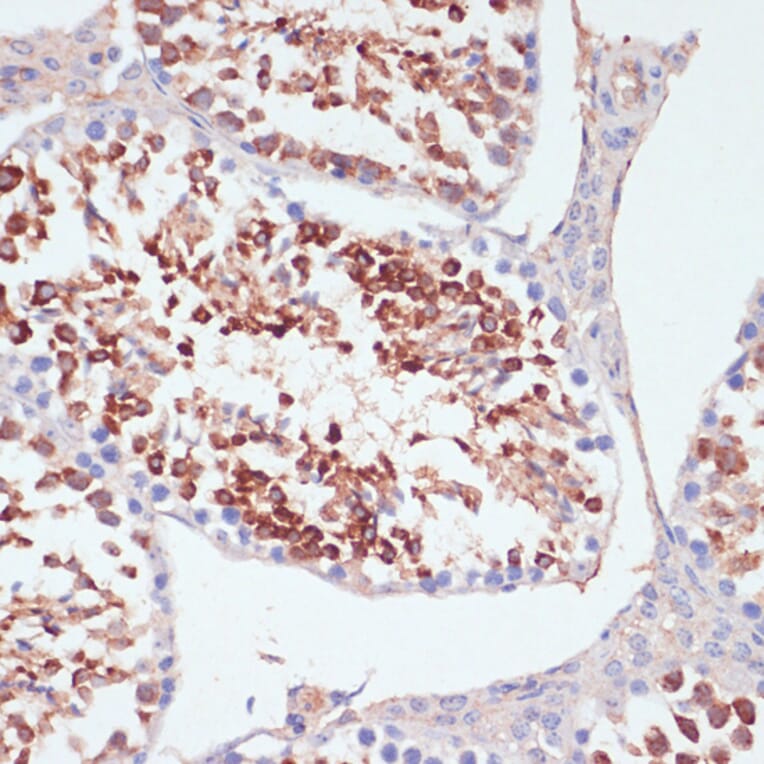 Immunohistochemistry - Anti-PKC delta Antibody (A8410) - Antibodies.com