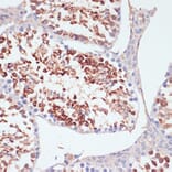 Immunohistochemistry - Anti-PKC delta Antibody (A8410) - Antibodies.com
