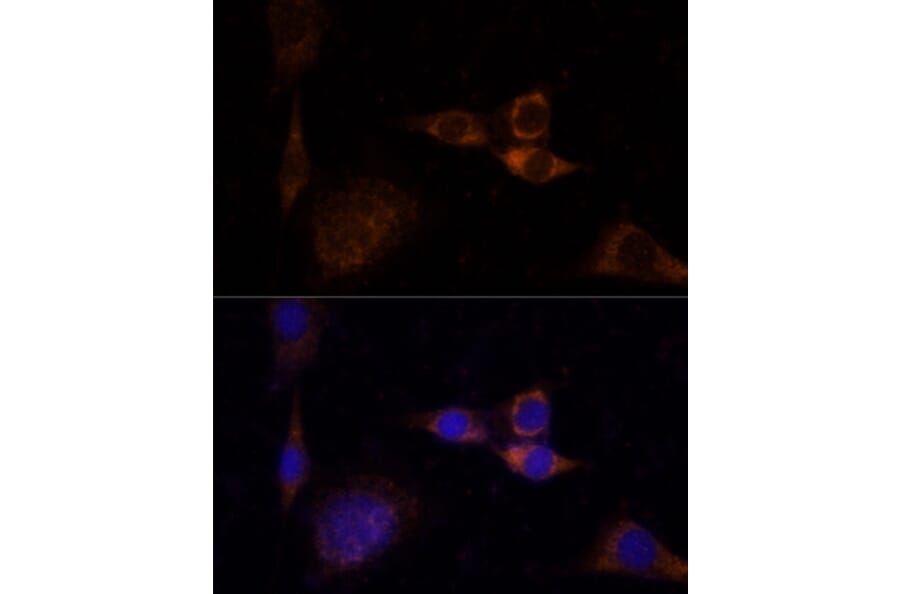 Immunofluorescence - Anti-PKC delta Antibody (A8410) - Antibodies.com