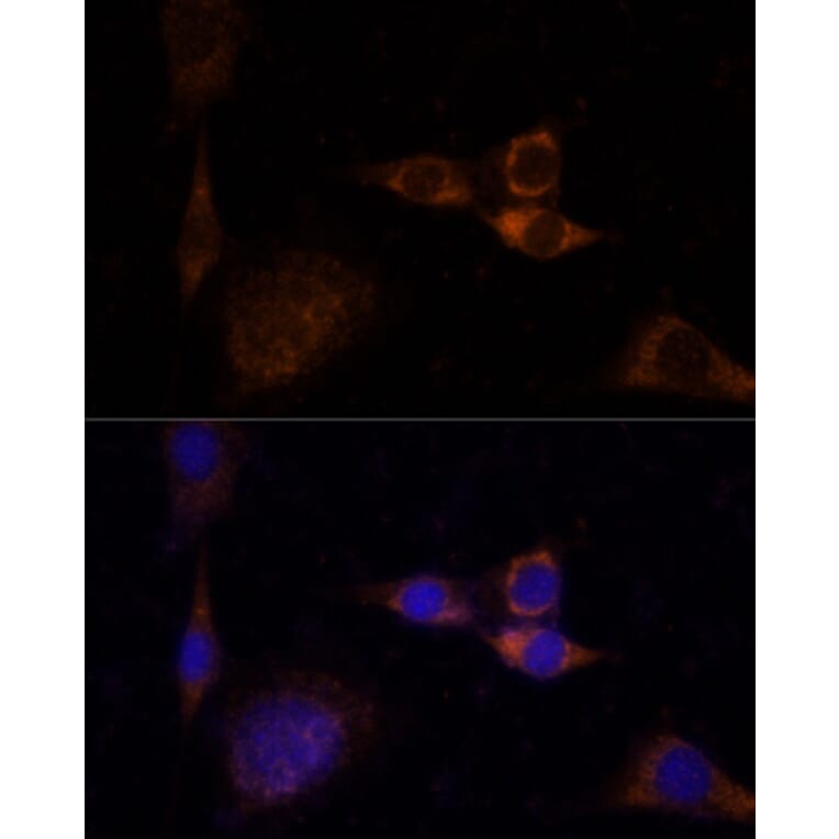 Immunofluorescence - Anti-PKC delta Antibody (A8410) - Antibodies.com
