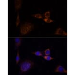 Immunofluorescence - Anti-PKC delta Antibody (A8410) - Antibodies.com