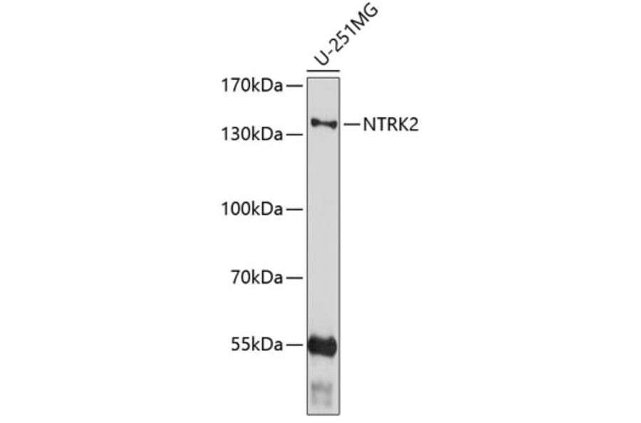 Western Blot - Anti-NTRK2 Antibody (A0487) - Antibodies.com