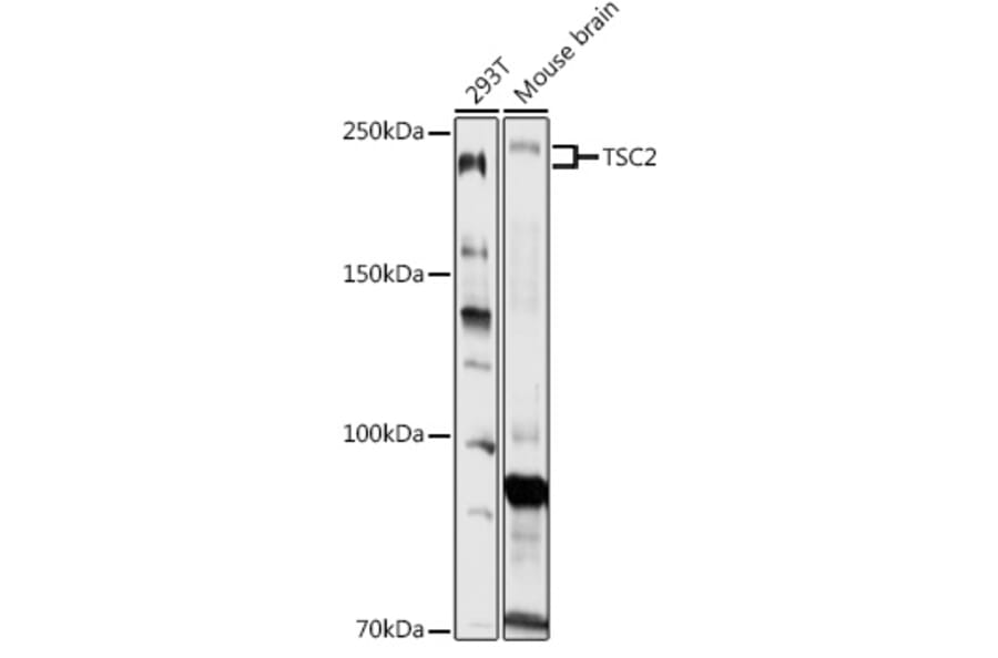 Western Blot - Anti-Tuberin Antibody (A8413) - Antibodies.com