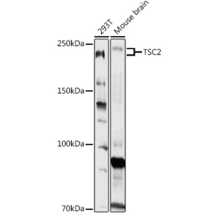 Western Blot - Anti-Tuberin Antibody (A8413) - Antibodies.com