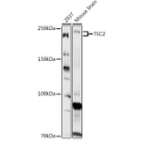 Western Blot - Anti-Tuberin Antibody (A8413) - Antibodies.com