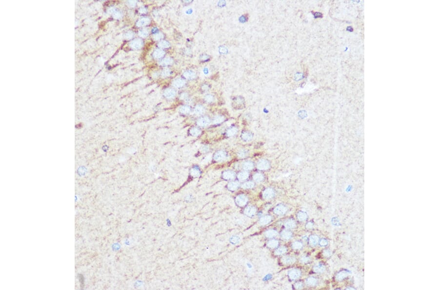 Immunohistochemistry - Anti-Tuberin Antibody (A8413) - Antibodies.com