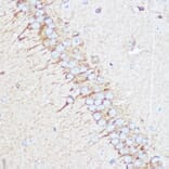 Immunohistochemistry - Anti-Tuberin Antibody (A8413) - Antibodies.com