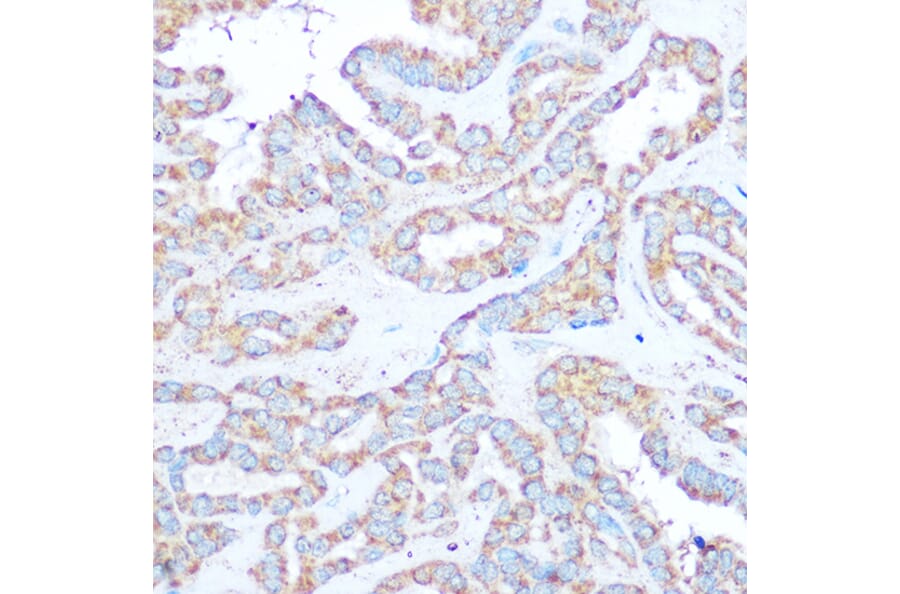 Immunohistochemistry - Anti-Tuberin Antibody (A8413) - Antibodies.com