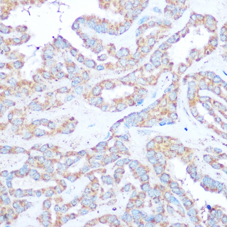 Immunohistochemistry - Anti-Tuberin Antibody (A8413) - Antibodies.com