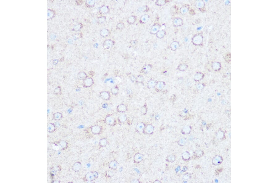 Immunohistochemistry - Anti-Tuberin Antibody (A8413) - Antibodies.com