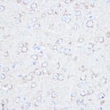 Immunohistochemistry - Anti-Tuberin Antibody (A8413) - Antibodies.com