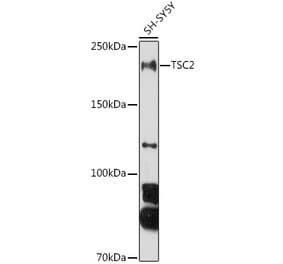 Western Blot - Anti-Tuberin Antibody (A8414) - Antibodies.com