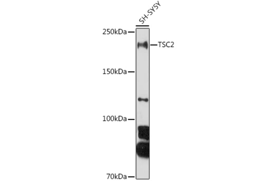Western Blot - Anti-Tuberin Antibody (A8414) - Antibodies.com