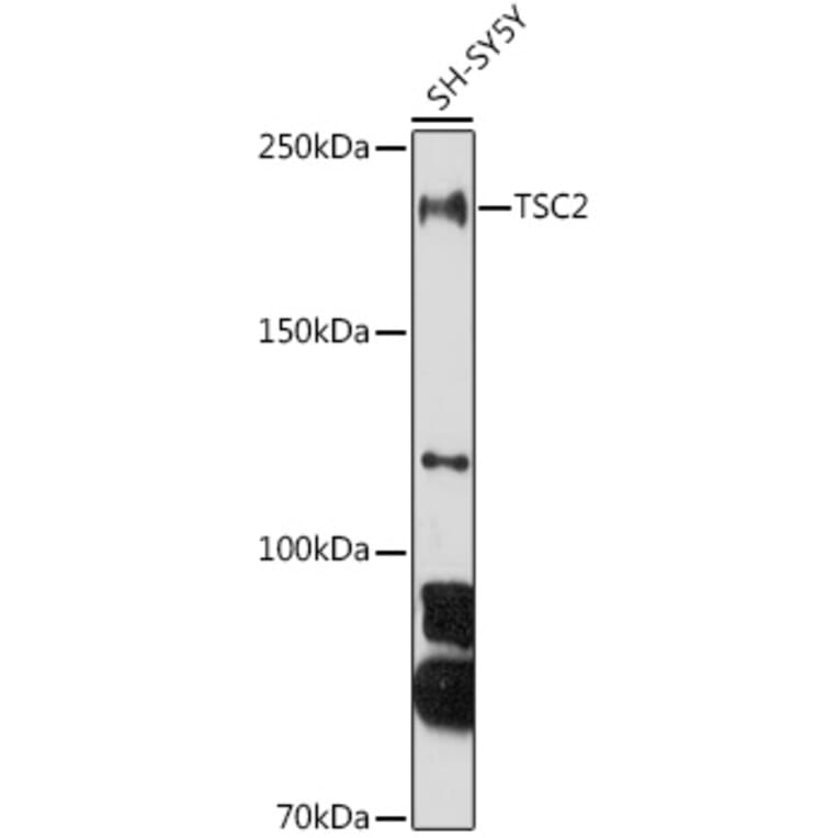 Western Blot - Anti-Tuberin Antibody (A8414) - Antibodies.com