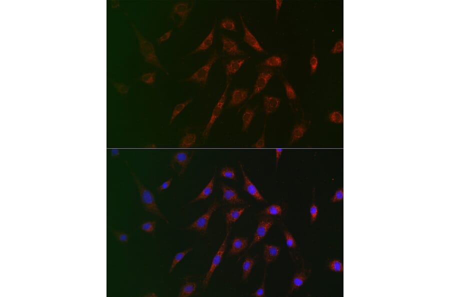 Immunofluorescence - Anti-Tuberin Antibody (A8414) - Antibodies.com
