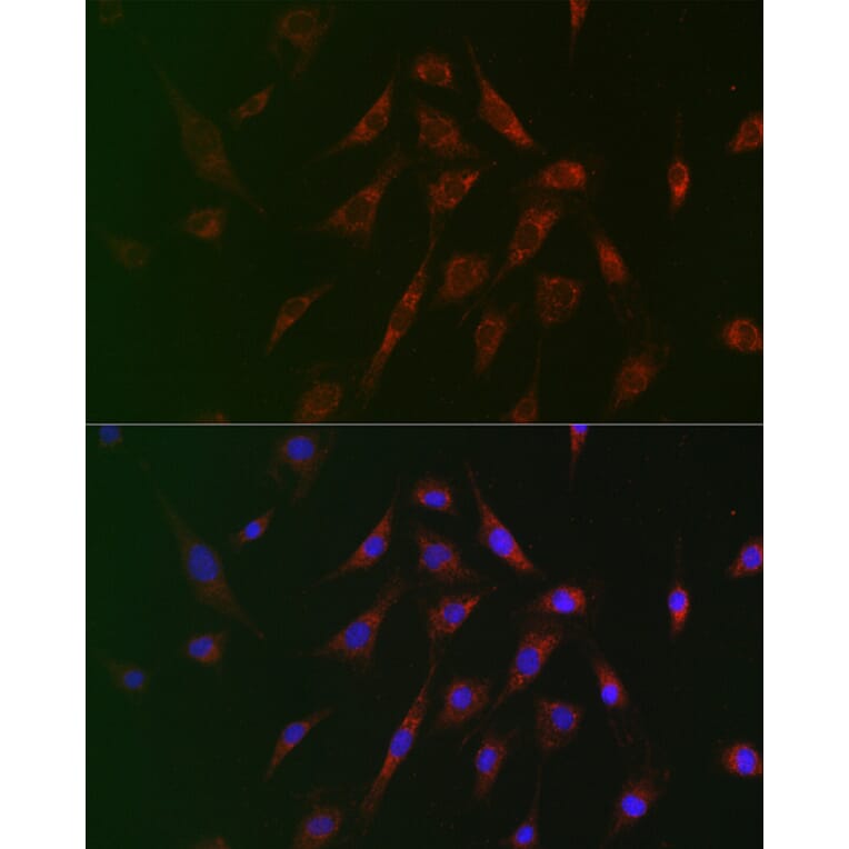 Immunofluorescence - Anti-Tuberin Antibody (A8414) - Antibodies.com