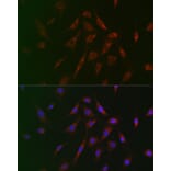 Immunofluorescence - Anti-Tuberin Antibody (A8414) - Antibodies.com