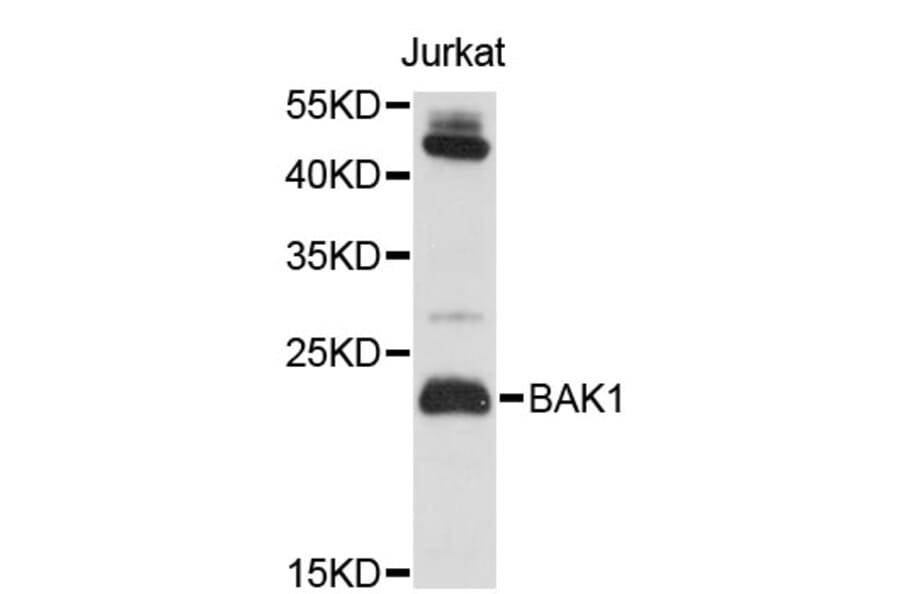 Western Blot - Anti-BAK1 Antibody (A0497) - Antibodies.com