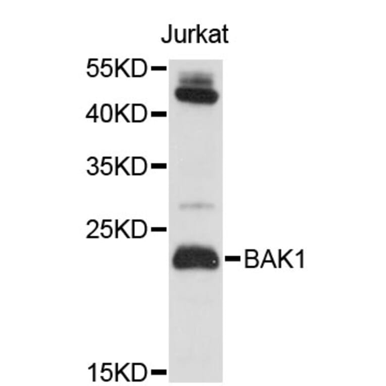 Western Blot - Anti-BAK1 Antibody (A0497) - Antibodies.com