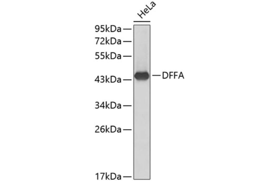 Western Blot - Anti-DFFA Antibody (A0507) - Antibodies.com