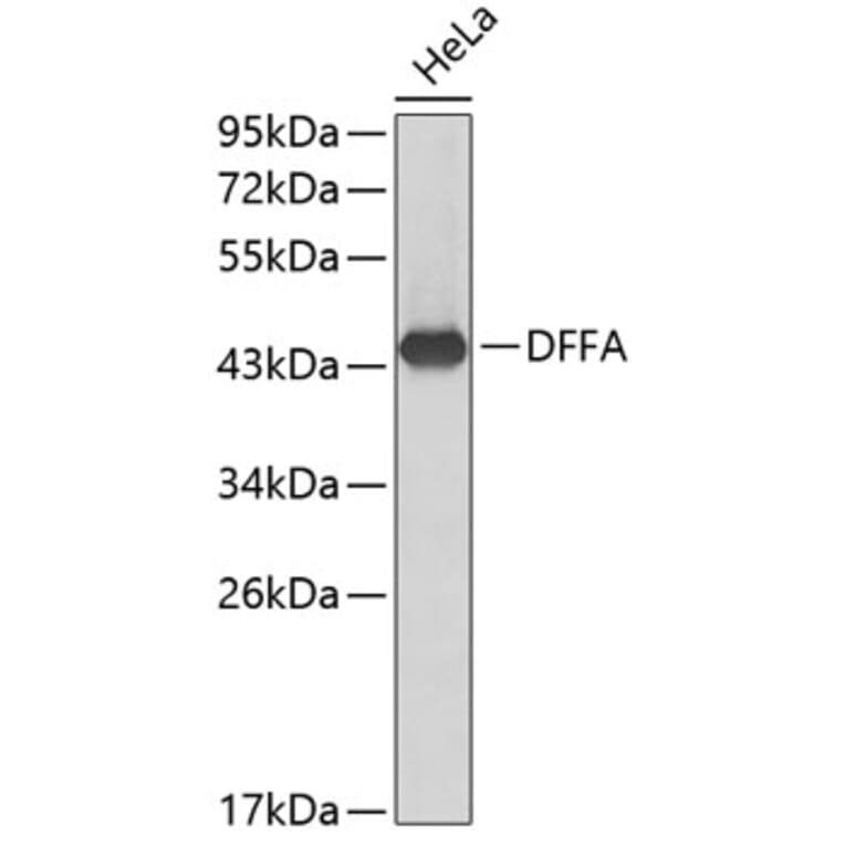 Western Blot - Anti-DFFA Antibody (A0507) - Antibodies.com