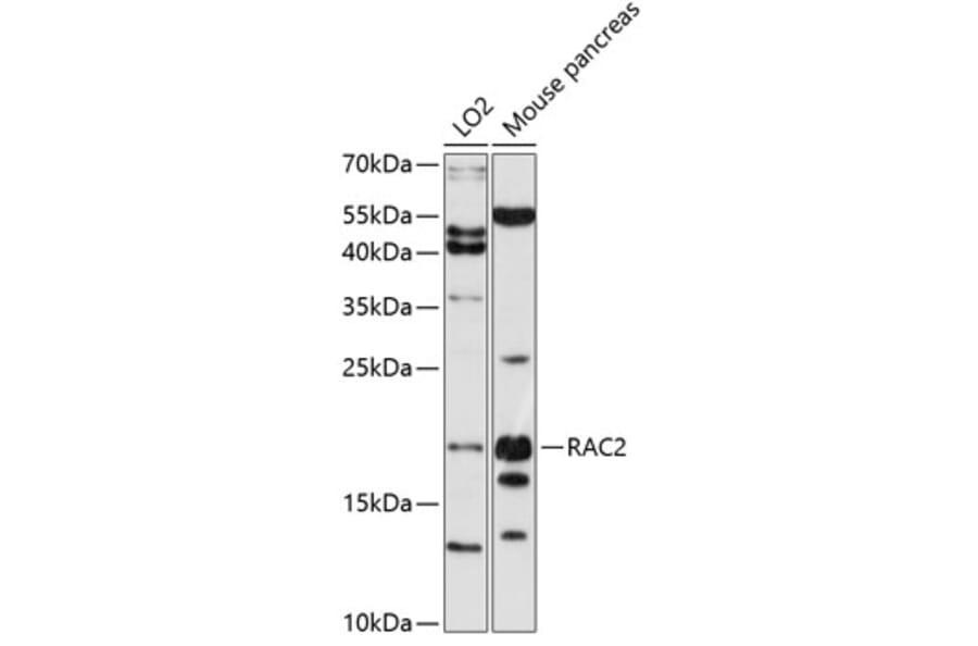 Western Blot - Anti-RAC2 Antibody (A0509) - Antibodies.com