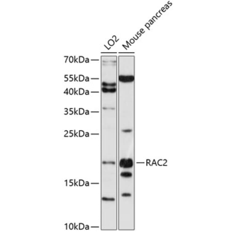 Western Blot - Anti-RAC2 Antibody (A0509) - Antibodies.com