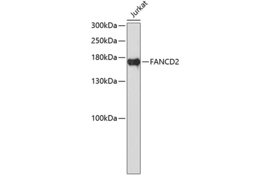 Western Blot - Anti-FANCD2 Antibody (A0521) - Antibodies.com