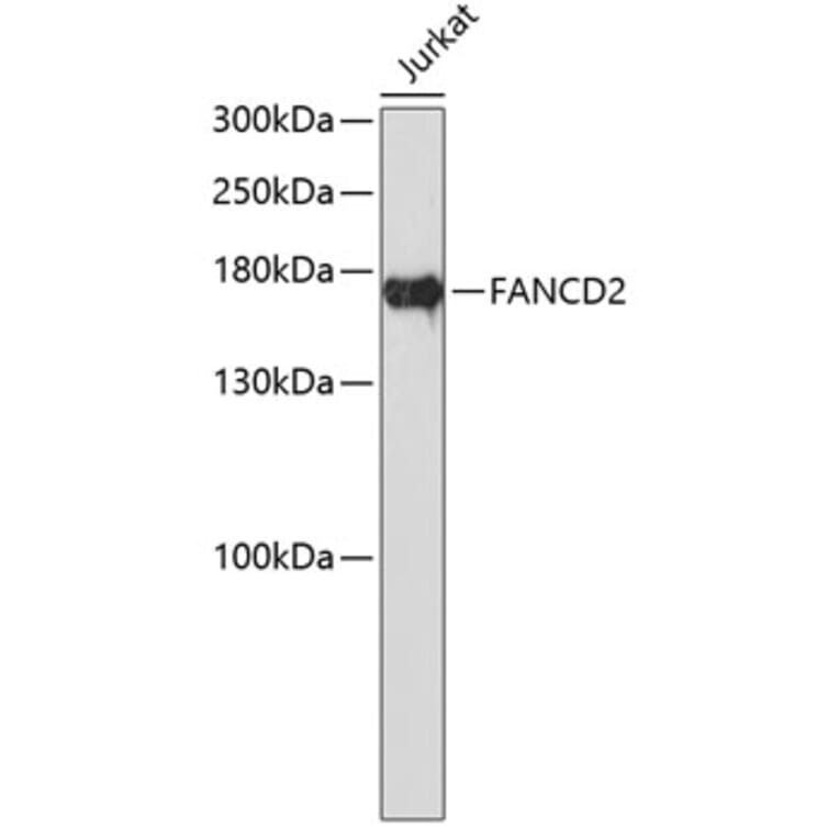 Western Blot - Anti-FANCD2 Antibody (A0521) - Antibodies.com
