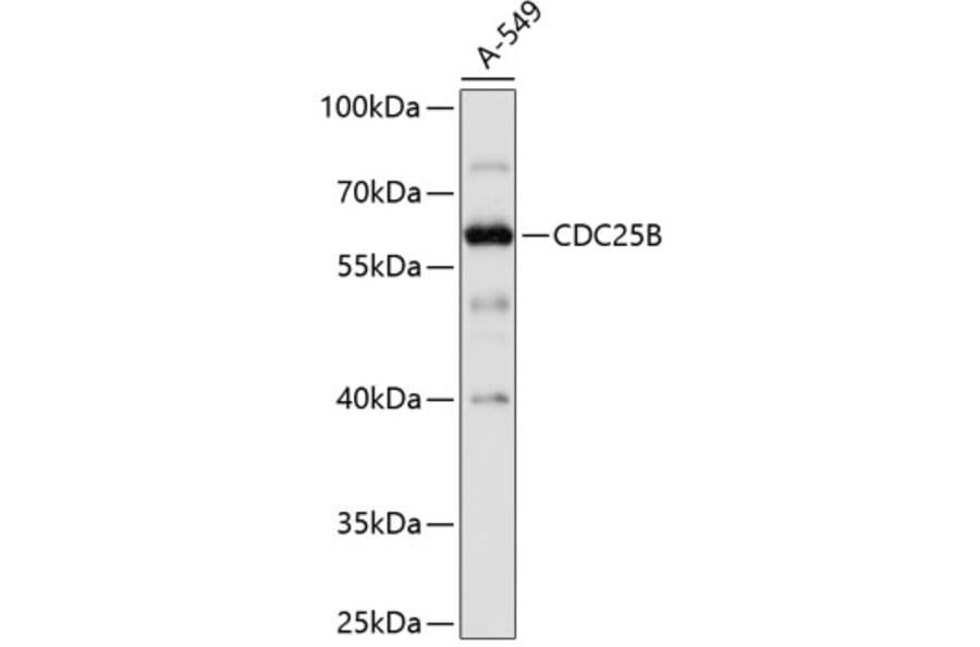 Western Blot - Anti-CDC25B Antibody (A0534) - Antibodies.com
